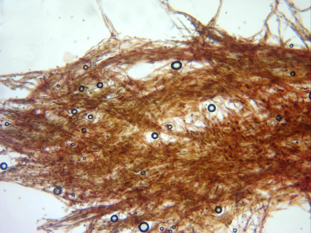 Microscopía de Cystoagaricus populinus - 13 - Escamas sombrero x 100